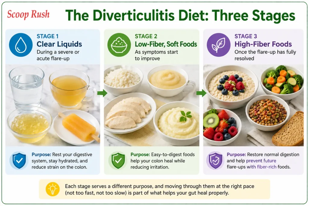 The Diverticulitis Diet: Three Stages |Scoop Rush